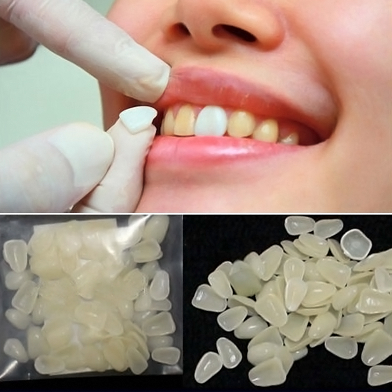 Dental Ultra-Thin Whitening Veneers Resin Teeth Upper ...