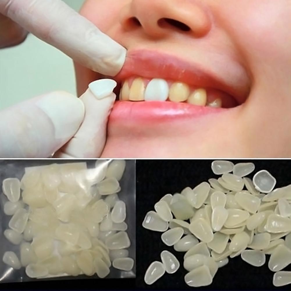 Временные зубы из пластмассы