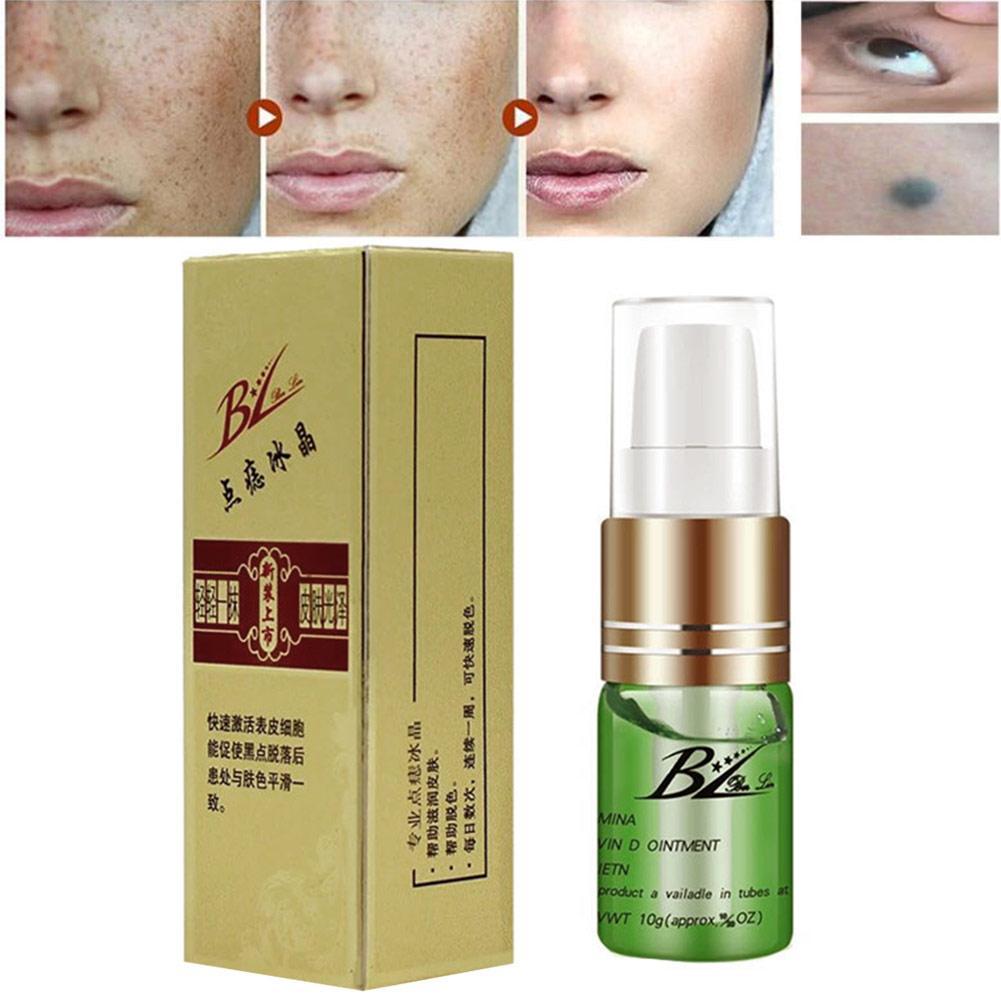 Painless Mole Skin Dark Spot Removal Face Wart Tag Freckle ...