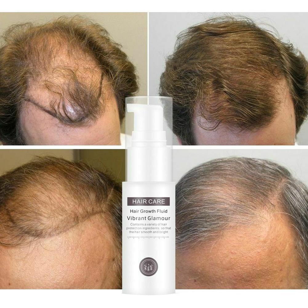 Hair Growth Essence Essential Oil Liquid Spray Nourish Thick Roots