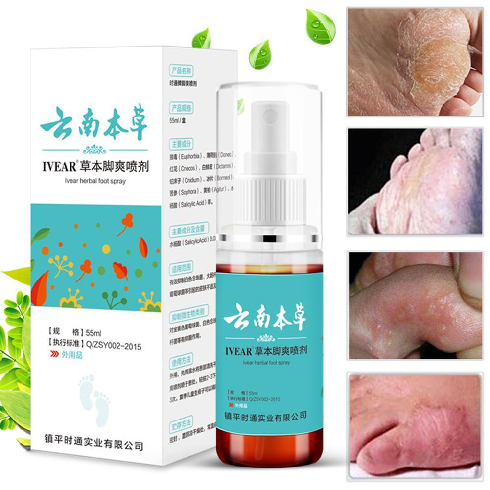 Herbal medicine to remove athlete's foot spray for athlete's foot 55ml ...