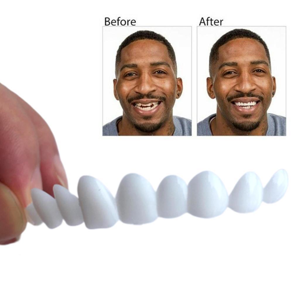 magic teeth brace