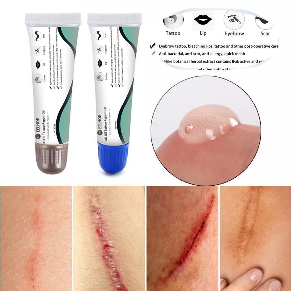 eelhoe scar removal cream