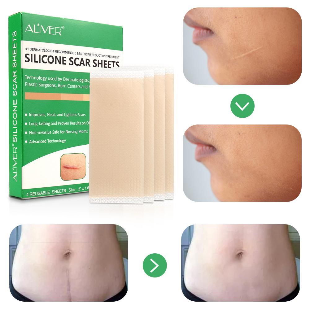 scar reduction silicone sheets