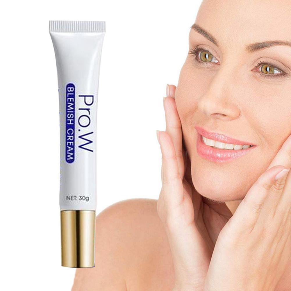 different acne cream