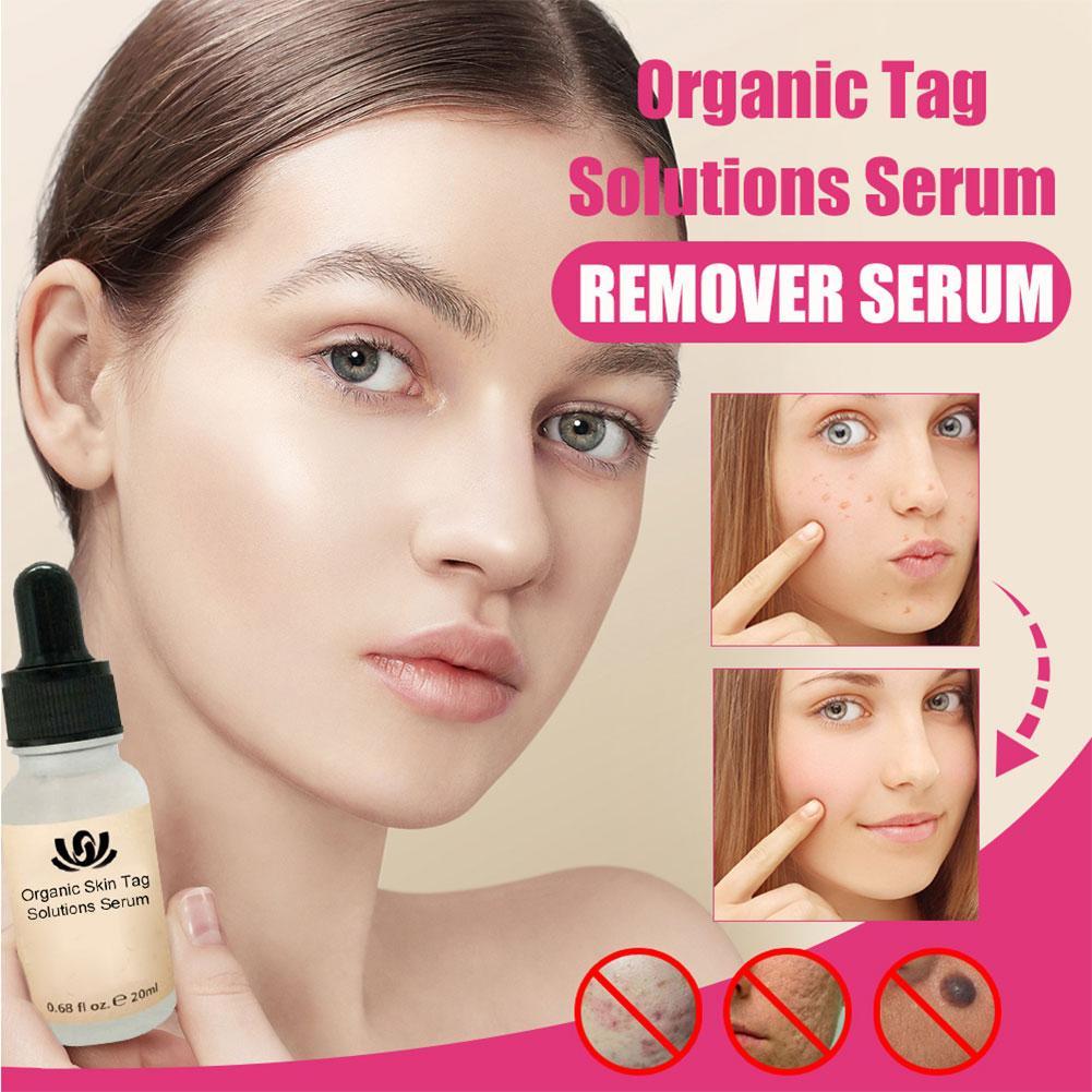 skin tag solution serum