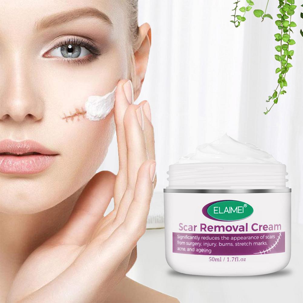 scar removal cream for stretch marks