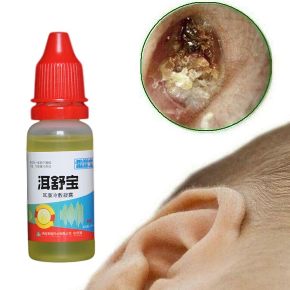 Otitis Media Adult Ear Fluid Treatment My XXX Hot Girl