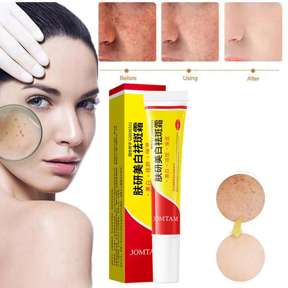 Effective Whitening Cream Freckle Remove Melasma Acne Spot Pigment Melanin  Dark Spots Pigmentation Moisturizing Gel Skin Care - Emulsion - AliExpress