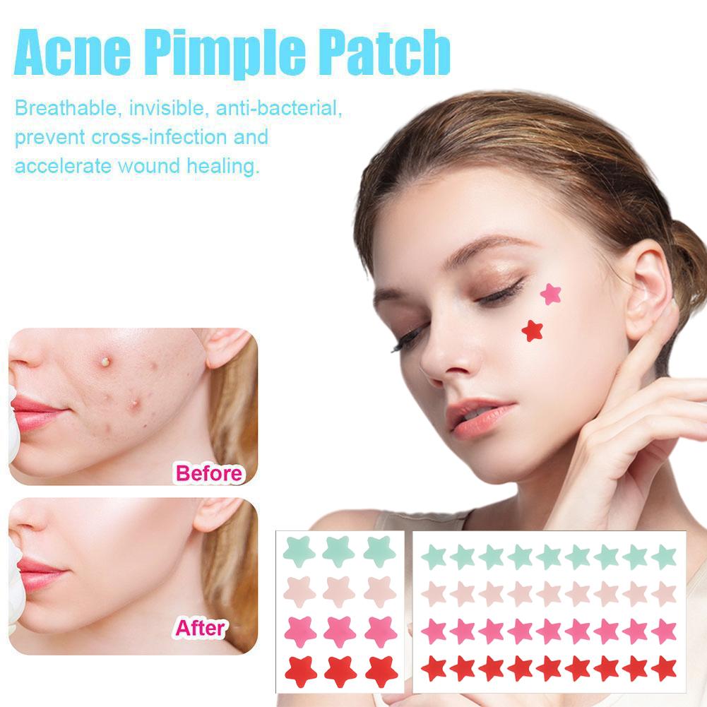 thumbnail image 4 of Ruifaya Parche para eliminar las espinillas y el acné de Star Acnes Película para eliminar las espinillas y el acné Nueva U7, 4 of 7
