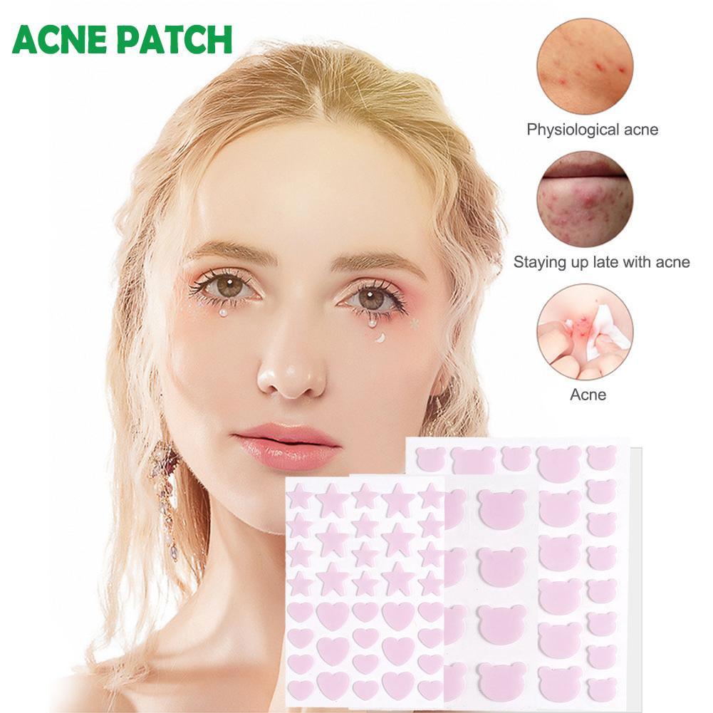 thumbnail image 2 of Wartleves Parches para el acné a prueba de agua, adhesivo hidrocoloide para eliminar espinillas, para uso facial en coche;, 2 of 7