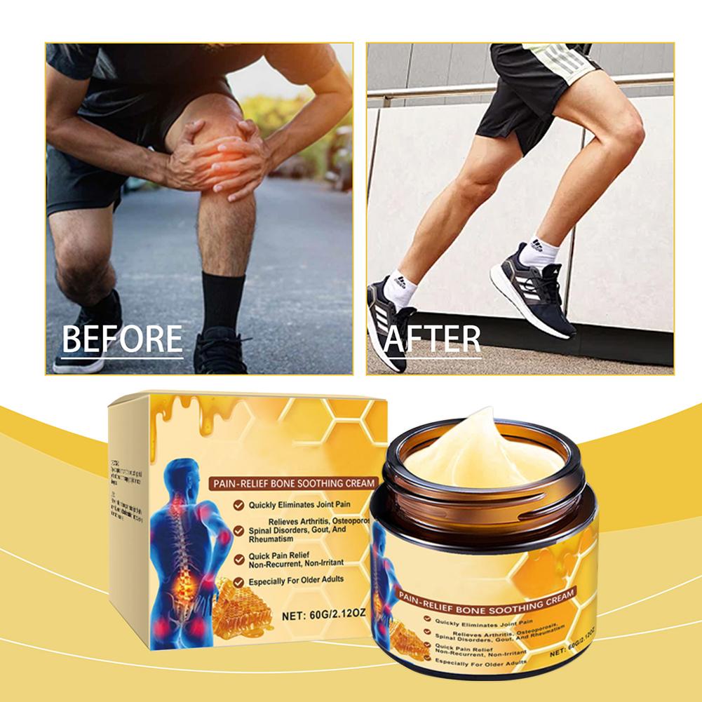 Bienengift Creme, Aetheris Bienengift Sofortige Ultra Starke Creme, Bienenvenen Fortgeschrittene Gelenk- Und Knochen Creme, Bee Venom Cream 60G