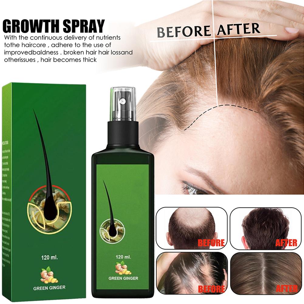 thumbnail image 4 of Ruifaya Loción capilar - 30/120 ml Neo Hair Oil Crecimiento del cabello Economía verde - 1 unidad Tailandia, 4 of 7